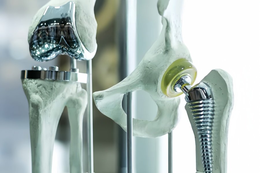 Stainless Steel Medical Implants